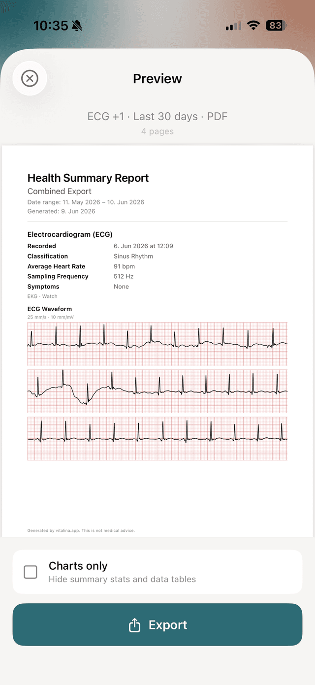 vitalina PDF preview showing the Apple Watch ECG waveform on a classic red clinical grid with classification, average heart rate, and sampling frequency