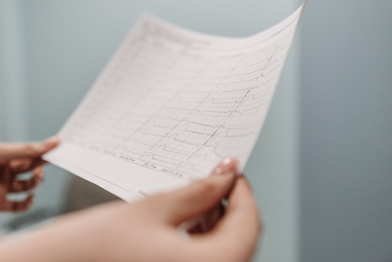 Doctor reviewing a printed ECG report and cardiology test results