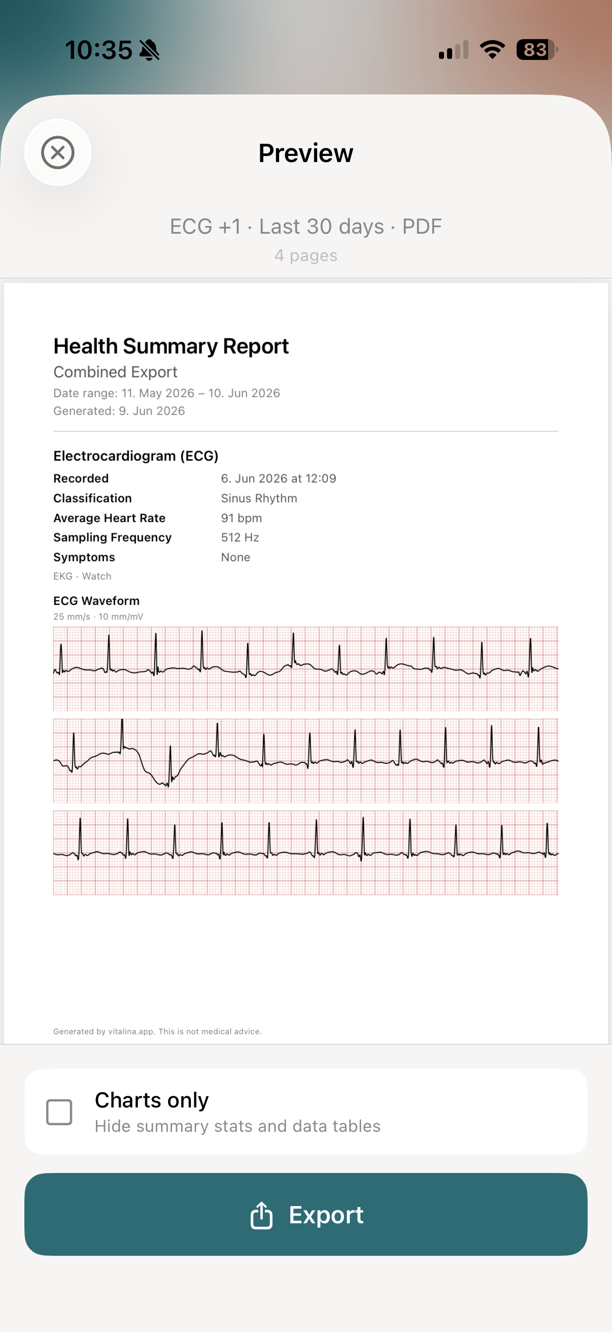 vitalina PDF preview showing the Apple Watch ECG waveform on a classic red clinical grid with classification, average heart rate, and sampling frequency